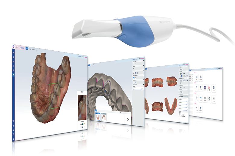 Intraoral scanner Hungría