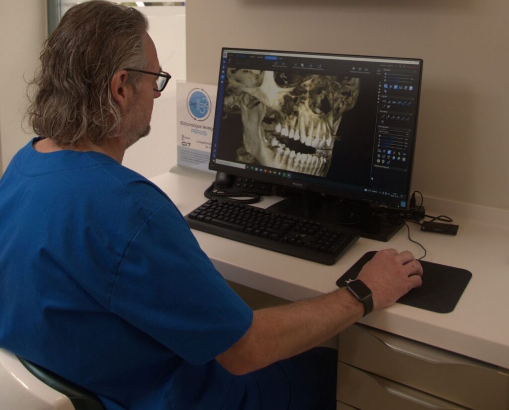 Rehabilitación dental completa en el extranjero: Budapest, Hungría