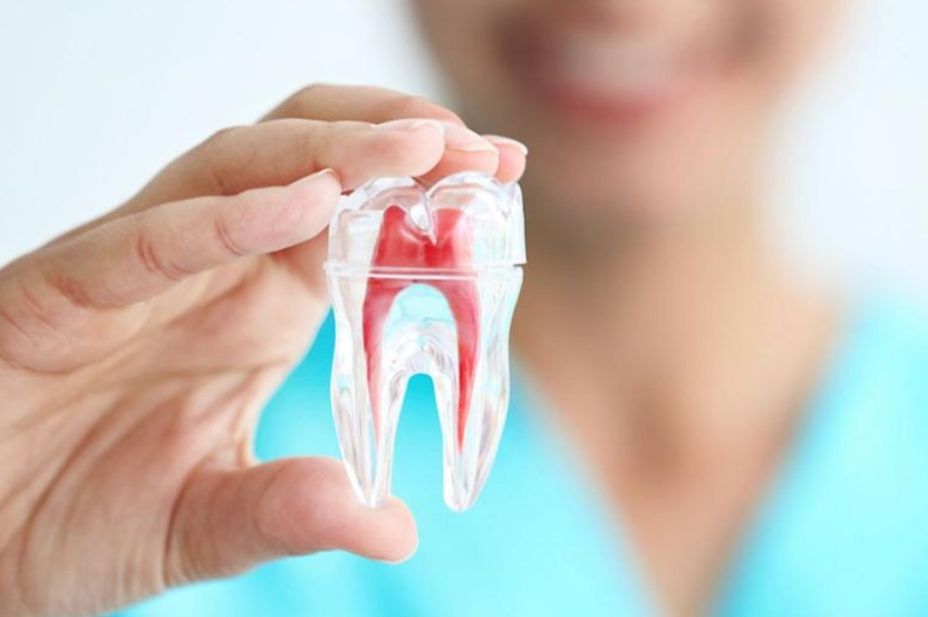 ¿Qué garantía tienen los implantes dentales?